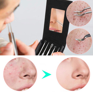 Stainless Steel Acne Needle Set 6 Piece With Mirror Portable Blackhead Remover For Face Skin Care Tools - Product Image 2
