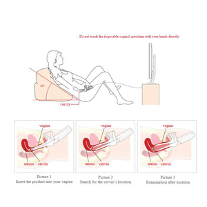 Novo Vaginoscópio <span class=keywords><strong>Digital</strong></span> Eletrônico Portátil Mini para Exames Ginecológicos - Product Image 4