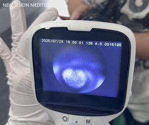 Caméra professionnelle Fundus pour animaux de compagnie Caméra rétinienne <span class=keywords><strong>portable</strong></span> non mydriatique pour vétérinaire - Product Image 5