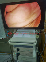 Système de caméra endoscopique laparoscopique Mindray HD3 Full HD avec 3 capteurs CMOS, zoom optique 2x, tour chirurgicale complète pour interventions mini-invasives