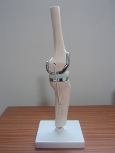 Hoogwaardig PVC afneembaar kunstmatig klein dubbel zilveren kniegewricht implantaat modelset medisch wetenschappelijk oefenmodel voor protheses - Product Image 4