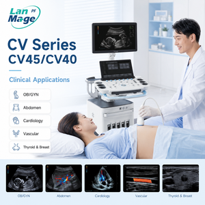 Sistema de Ultrasonido Doppler Color con Imágenes de IA y Monitor de 21.5 Pulgadas para Clínicas de Cardiología, Vascular y Obstetricia - Product Image 1