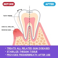 Mousse dentifrice blanchissante OEM pour enfants, protection profonde, usage domestique, nettoie les dents, prévient la saleté, hygiène buccale