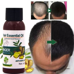 Aceite Capilar de Jengibre Mokeru 30ml, Promueve el Crecimiento del Cabello y Previene la Caída, Fórmula Concentrada de Materiales Naturales para Cabello <span class=keywords><strong>Grueso</strong></span>, para Mujeres y Hombres - Product Image 3