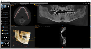 Conveniente Usato Carestream: Combinazione Panoramica CS 9000C 3D Panorex CEPH CONE BEAM per Imaging Panoramico e Cefalometrico - Product Image 3