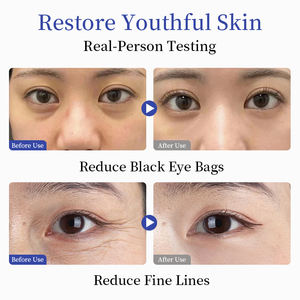 Nemlendirici ve anti-şişlik faydaları ile peptid ve hyaluronik asit anti-kırışıklık yatıştırıcı göz kremi - Product Image 6