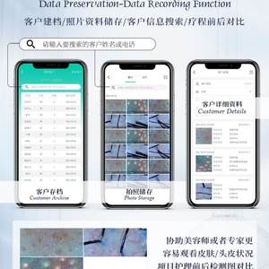 เครื่องตรวจสภาพหนังศีรษะแบบไร้สาย, บันทึกและจัดเก็บข้อมูลลูกค้า, เครื่องตรวจสภาพหนังศีรษะและรูขุมขนแบบพกพา, ศูนย์ดูแลเส้นผม - Product Image 4