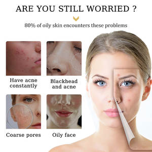 Venta al por mayor muy eficaz de la piel blanqueamiento de glutatión cara crema - Product Image 4