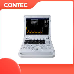 CONTEC-máquina de diagnóstico de frecuencia cardíaca, sistema de ultrasonido de color para diagnosticar ginecología abdominal y ginecología, modelo CMS1700B - Product Image 2