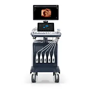 Sonoscape P60 Veterinaire Kleur Echografie, Medische Ultrasone Instrumenten Ultrasoon Sonoscape