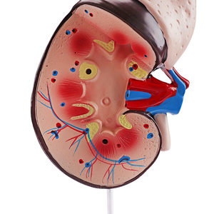 Modelo biológico de tamaño natural, modelo de enseñanza de riñón humano, modelo de riñón de una parte - Product Image 5
