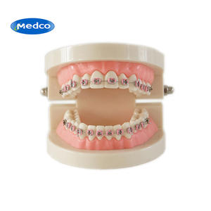 แบบจำลองทันตกรรมจัดฟันพร้อมเหล็กจัดฟันแบบมีสี อุปกรณ์สอนสำหรับการรักษาทางช่องปาก สำหรับผู้ใหญ่ - Product Image 2
