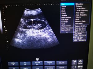 Mesin USG Portabel Warna PW Termurah Mesin USG Veteriner untuk Klinik B/W Laptop USG - Product Image 3