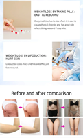 Prix Usine 3-en-1 8G Max Appareil de Massage Vibratoire G-8 pour Élimination de la Cellulite par Aspiration et Chauffage, Ventouses Amincissantes Portables en ABS