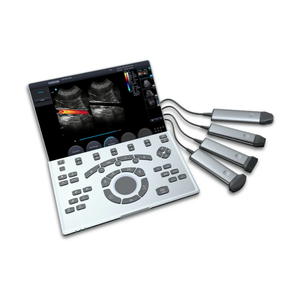 Sistema de Ultrasonido Doppler a Color Veterinario Portátil Chison Sonoair 70 VET con Pantalla LCD de Alta Resolución - Product Image 1