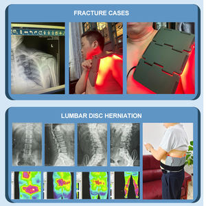 Thérapie musculaire infrarouge Dispositif thérapeutique à la lumière <span class=keywords><strong>laser</strong></span> pour le soulagement de la douleur corporelle <span class=keywords><strong>Acupuncture</strong></span> LLLT PBM Traitement des plaies Physiothérapie - Product Image 5