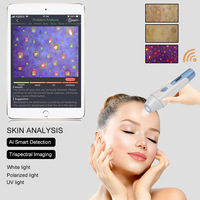 Analizador de Piel Profesional para iPad, Compatible con iOS y Android, Escáner Avanzado de Análisis de Pigmentación, de Fabricante Chino