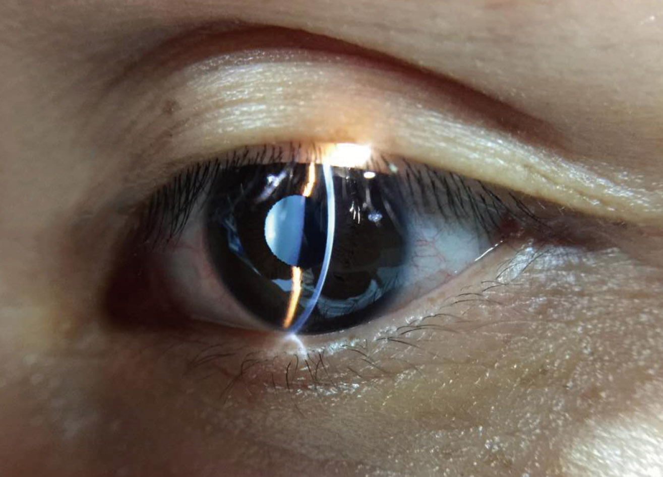 eye photography machine