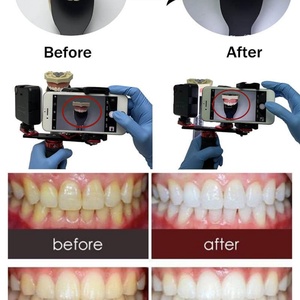 Kit de Iluminación LED para Fotografía Dental, Cámara Oral, Luz de Relleno, Luz de Video de Alto Brillo, para Hogar, Salón, Hospital - Product Image 5