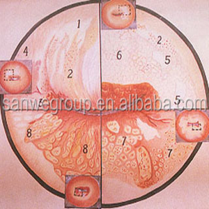 SW-3303 डिजिटल ऑप्टिकल कोपोस्कोप/अस्पताल डिजिटल इलेक्ट्रॉनिक कोपोस्कोप - Product Image 5