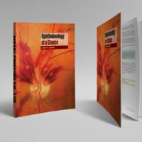 Oftalmología de un vistazo Libro de texto médico Impresión personalizada Pequeño MOQ Encuadernación de costura encuadernada perfecta