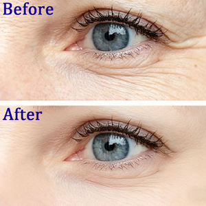 مسحوق الببتيدات التجميلية المضادة للتجاعيد CAS:868844-74-0 أسيتيل أوكتابيبتيد-3 /SNAP-8 - Product Image 6