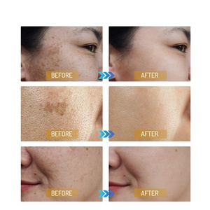 Meilleures Ventes – Sérum Éclaircissant Anti-Taches 377 pour le Visage, 30 ml, Marque Privée, Essence Blanchissante pour Taches Pâles - Product Image 6