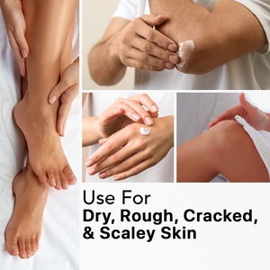 Crema per Piedi Biologica OEM/ODM Etichetta Privata, Idratante all'Urea, Riparazione Pelle Secca, Riparazione Talloni Screpolati, Crema per Mani <span class=keywords><strong>e</strong></span> Piedi - Product Image 4