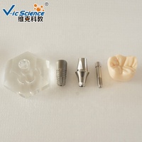 Modèle d'implant dentaire stéréoscopique Dents et modèle dentaire Modèle d'implant dentaire pour les applications en sciences médicales