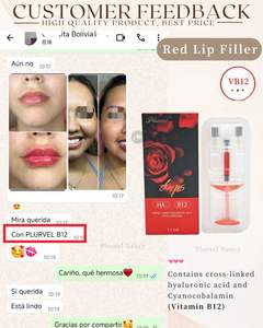 Gel d'acide hyaluronique monophasique CE le mieux noté pour les lèvres / Remplisseur de lèvres à teinte rouge douce avec vitamine B12, <span class=keywords><strong>injection</strong></span> pour les lèvres - Product Image 6