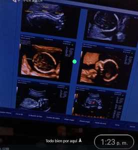 Échographe <span class=keywords><strong>portable</strong></span> couleur <span class=keywords><strong>Doppler</strong></span> pour diagnostic médical, appareil d'échographie <span class=keywords><strong>portable</strong></span> - Product Image 4