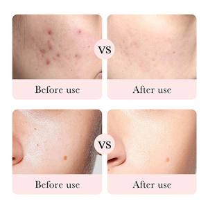 Crème <span class=keywords><strong>anti</strong></span>-âge tout-en-un - Avec du rétinol, de la vitamine C, de l'acide azélaïque et de l'aloe vera pour raffermir, estomper les rides, éclaircir les cernes - Product Image 4