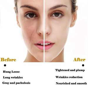 Rodillo Facial Reafirmante Antienvejecimiento y Antiarrugas con Piedras Preciosas, Rodillo de Belleza con Vibración, Masajeador Energético, Barra de Belleza de Oro de 24K - Product Image 5