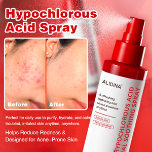 <span class=keywords><strong>Spray</strong></span> quotidien à l'acide hypochloreux B OEM ODM pour les boutons et les rougeurs, soin de la peau du visage multi-usages, réparation cutanée, soin de la peau coréen - Product Image 1