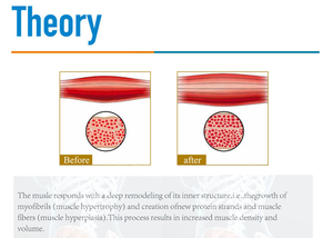 Adss Xách Tay <span class=keywords><strong>EMS</strong></span> Cơ Thể Hệ Thống Cơ Thể Hình Định Hình <span class=keywords><strong>EMS</strong></span> Cơ Bắp Đào Tạo Kích Thích Máy - Product Image 4
