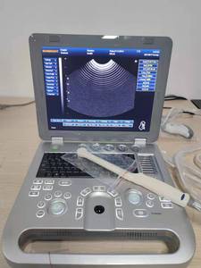 Instrument à ultrasons 3D pour ordinateur portable médical à écran de 15 pouces pour humain avec sonde OB/GYN/vasculaire/urologie - Product Image 2