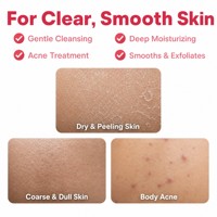 Gel Douche Acide Salicylique 2% Marque Blanche, Traitement Exfoliant pour l'Acné et Peaux Rugueuses, Lavant Corps Éclaircissant