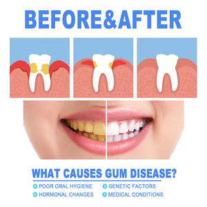 Gel de soin buccal pour le nettoyage en profondeur des taches dentaires et du tartre, gel de soin dentaire multi-usages pour les gencives enflées et douloureuses - Product Image 4