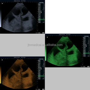 Pabrik! Mesin <span class=keywords><strong>ultrasound</strong></span>, pemindai portabel mandray <span class=keywords><strong>ultrasound</strong></span> <span class=keywords><strong>dp</strong></span> <span class=keywords><strong>10</strong></span> <span class=keywords><strong>ultrasound</strong></span> - Product Image 5