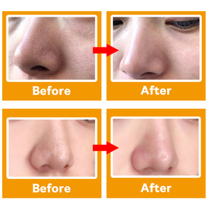 <span class=keywords><strong>De</strong></span> <span class=keywords><strong>la</strong></span> belleza <span class=keywords><strong>de</strong></span> alta calidad <span class=keywords><strong>de</strong></span> diamantes dispositivo Bestope Blackhead removedor - Product Image 4