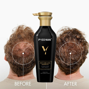 Champú Anticaída para Cabello Natural en Envase OEM, Tratamiento para Hombres con Línea de Cabello Recesiva, Bloqueador de DHT, Productos Anticaída para la <span class=keywords><strong>Alopecia</strong></span> - Product Image 3