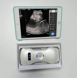 3 In 1 Portable Ultrasound Scanner 192 Element /Linear Convex Ultrasound Probe Ultrasound Scanner