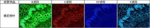 Microscopio de Fluorescencia Phenix <span class=keywords><strong>Epi</strong></span> BMC603FLED-SD, Microscopio Fluorescente Trinocular Profesional, Microscopio Digital - Product Image 6