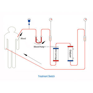 Tıbbi tek kullanımlık kan hattı hemodiyaliz kateter kan boru seti kan dialyzer tüp diyaliz merkezi hastane klinik - Product Image 6