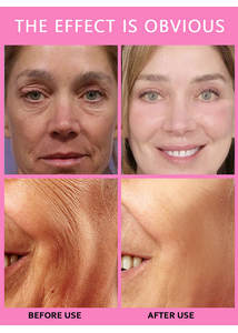 <span class=keywords><strong>1000</strong></span> MG di collagene Gluta sbiancamento della pelle macchie scure orso Gummies integratore sanitario caramelle - Product Image 5