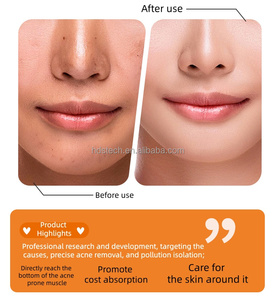 Cerotti Idrocolloidali Invisibili per Acne con Acido Salicilico per <span class=keywords><strong>Punti</strong></span> <span class=keywords><strong>Neri</strong></span> e Comedoni Chiusi, Attenua i Segni dell'Acne, per Tutto il Viso, 3 Cerotti per Tutti i Tipi di Pelle - Product Image 6