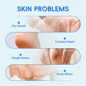 LAIKOU Crema all'Urea 40% per <span class=keywords><strong>Pelle</strong></span> Ruvida e Secca, Esfoliante con 2% di Acido Salicilico, Crema Viso 100g - Product Image 3