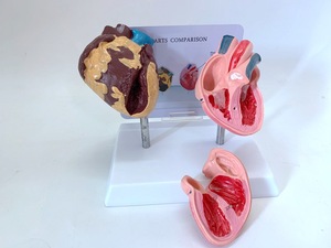 Modelo <span class=keywords><strong>de</strong></span> Anatomía <span class=keywords><strong>de</strong></span> Órganos Humanos para Comparar Corazones Patológicos y Sanos, <span class=keywords><strong>de</strong></span> Plástico, para Educación Médica, Yulin YL2-30079 - Product Image 3