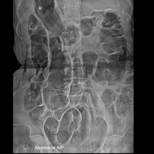 IRAY kablosuz Mars 1417 veteriner/İnsan <span class=keywords><strong>DR</strong></span> <span class=keywords><strong>x</strong></span> <span class=keywords><strong>ray</strong></span> düz panel dedektör 14*17/17 * 17FPD dijital düz panel dedektör hastane için - Product Image 6