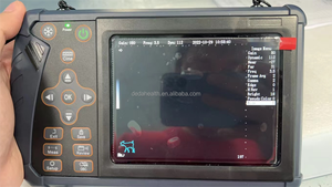 Escáner de ultrasonido veterinario B/W portátil superventas DMSU07 adecuado para examen <span class=keywords><strong>abdominal</strong></span> de vacas y ovejas - Product Image 4